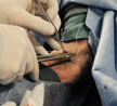 The Art of Arthroscopy