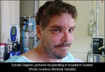 Gagnon Comments On Accident